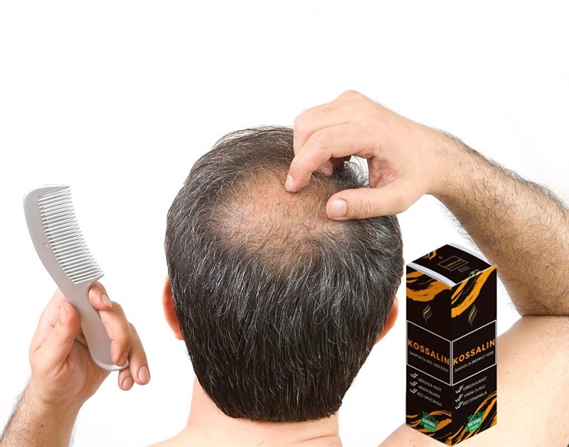 kossalin šampon za rast kose iskustva djelovanje sastav